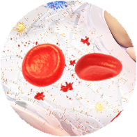 Anemia Anemia